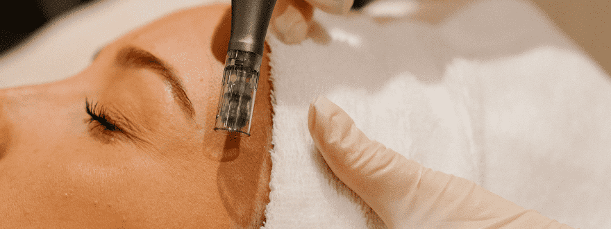 Salmon DNA Regenerative Needling